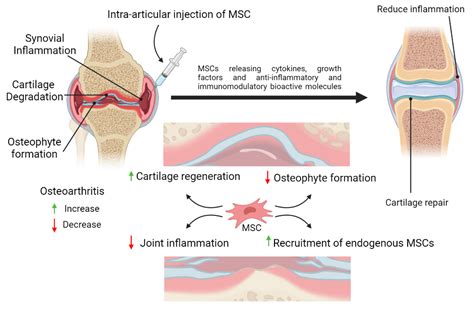Fibrocartilageis the thick tissue that forms the disksof the AC and SC joints and the labrum, the ring that deepens the glenoid. . Articular sclerosis treatment